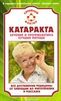 Катаракта Лечение и профилактика Лучшие методы артикул 3506a.